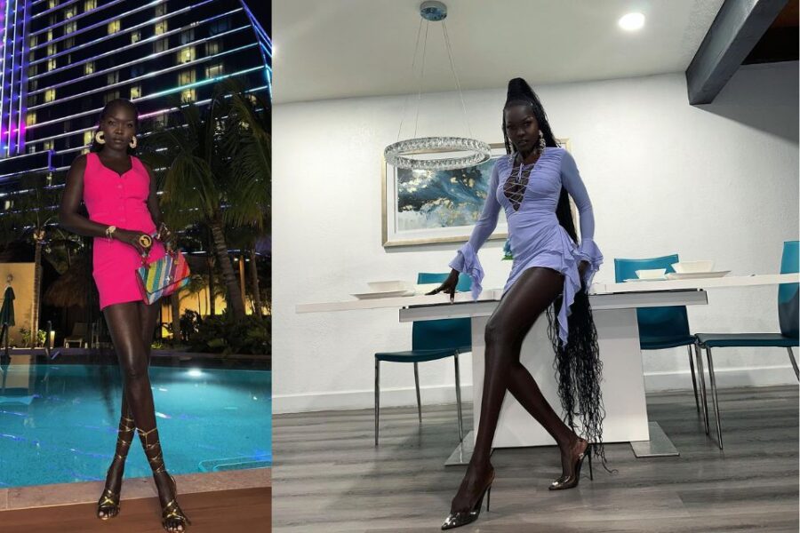 blackest person in the world